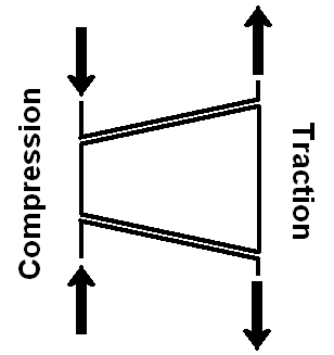 Hueter-Volkmann Law