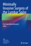 Minimally Invasive Surgery of the Lumbar Spine