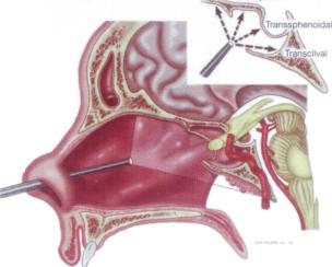 UPMC Min Invazive Endoscopic Image1